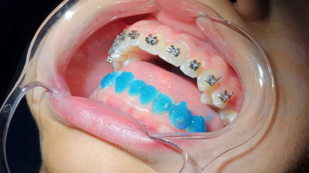 ortodoncia badajoz